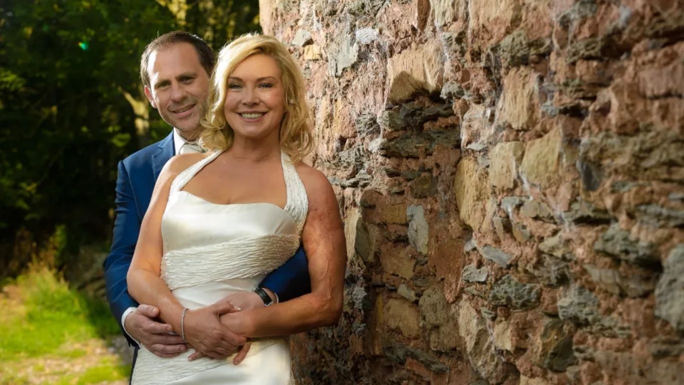 celebrities with noonan syndrome